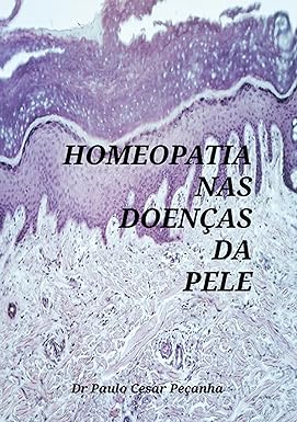 Homeopatia Nas Doenças Da Pele